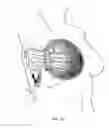 Fig. 07 - Methods and systems for breast reconstruction