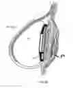 Fig. 09 - Methods and systems for breast reconstruction