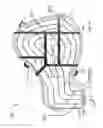 Fig. 18 - Methods and systems for breast reconstruction