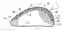 Fig. 01 - TISSUE EXPANDER WITH SELF-HEALING ANTERIOR SIDE
