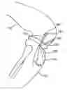 Fig. 01 - Canine ligament bone anchor and method