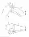 Fig. 02 - Canine ligament bone anchor and method