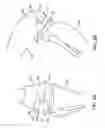 Fig. 03 - Canine ligament bone anchor and method