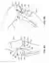 Fig. 05 - Canine ligament bone anchor and method