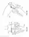 Fig. 07 - Canine ligament bone anchor and method