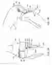 Fig. 08 - Canine ligament bone anchor and method