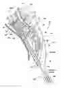 Fig. 01 - Methods and apparatus for performing therapeutic procedures in the spine