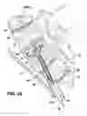 Fig. 22 - Methods and apparatus for performing therapeutic procedures in the spine