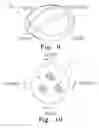Fig. 06 - Implantable patella component having a thickened superior edge