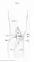 Fig. 02 - KNEE JOINT DEVICE AND METHOD