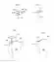 Fig. 06 - KNEE JOINT DEVICE AND METHOD