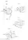 Fig. 12 - KNEE JOINT DEVICE AND METHOD
