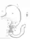 Fig. 02 - Pyloric obesity valve