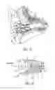 Fig. 02 - Always on headwear recording system