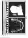 Fig. 07 - Custom orthodontic appliance forming method and apparatus