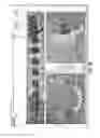 Fig. 16 - Custom orthodontic appliance forming method and apparatus