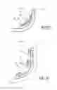 Fig. 06 - Sensor device and modular unit therefor