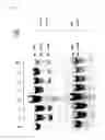 Fig. 03 - DHX36 / RHAU KNOCKOUT MICE AS EXPERIMENTAL MODELS OF MUSCULAR DYSTROPHY