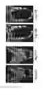 Fig. 41 - COMPOSITIONS AND METHODS FOR GENE EXPRESSION AND CHROMATIN PROFILING OF INDIVIDUAL CELL TYPES WITHIN A TISSUE