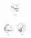 Fig. 35 - Ear warmer having a curved ear portion