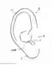 Fig. 01 - Methods and apparatus for ear protection