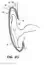 Fig. 03 - Methods and apparatus for ear protection