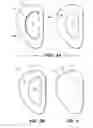 Fig. 04 - Methods and apparatus for ear protection