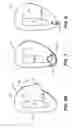 Fig. 06 - Methods and apparatus for ear protection
