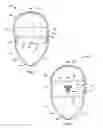 Fig. 03 - Padded head support