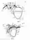Fig. 05 - Padded head support