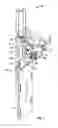 Fig. 02 - Surgical head support apparatus
