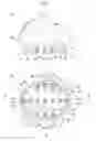 Fig. 02 - Scalp washing device