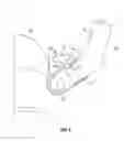 Fig. 03 - Upright vacuum cleaner
