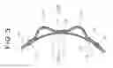 Fig. 04 - HOSE CLAMP
