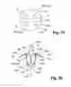 Fig. 12 - CLIP AND CLIP DEVICE