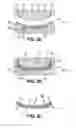 Fig. 03 - Molded product incorporating a label, and razor handle comprising such a molded product