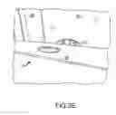Fig. 06 - SURFACE-MOUNTED WINDOW OPENING LIMIT DEVICE AND METHOD OF USE
