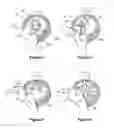 Fig. 04 - LOST MOTION CAM ACTUATING DEVICE