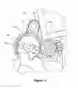 Fig. 06 - LOST MOTION CAM ACTUATING DEVICE