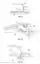 Fig. 06 - Systems and method for igniting explosives