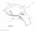 Fig. 02 - Egg separator