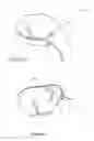 Fig. 04 - Egg separator