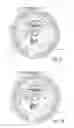Fig. 08 - Inhalation device and method of dispensing medicament