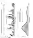 Fig. 34 - Device for calculating respiratory waveform information and medical instrument using respiratory waveform information