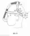 Fig. 22 - Patient interface assembly and system using same