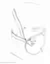 Fig. 01 - Collapse resistant respirator