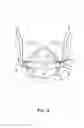Fig. 04 - Collapse resistant respirator