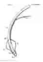 Fig. 01 - ENDOTRACHEAL CUFF AND TECHNIQUE FOR USING THE SAME
