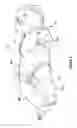 Fig. 03 - Bodysuit type garment for selective swaddling of an infant