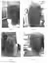 Fig. 04 - COMPOSITIONS AND METHODS FOR PERMANENT SHAPING OF HAIR